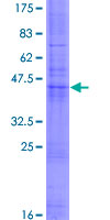 12.5% SDS-PAGE Stained with Coomassie Blue.